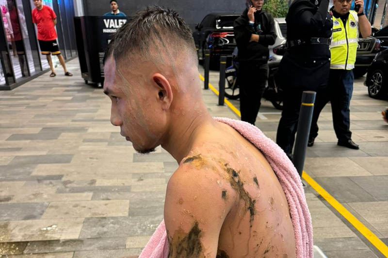 Seleccionado de Malasia sufre ataque con ácido en el cuerpo